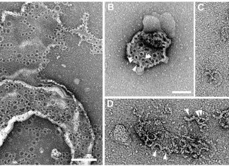 Gene called gasdermin E – aids cells in dying in an unexpected way, and may also suppress tumor growth