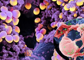 The autoimmune response in the HIV-positive patients is also linked to the presence of Staphylococcus aureus in the blood