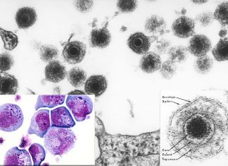 Herpes virus linked to bipolar disorder and/or severe depression