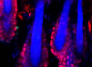 Melanocyte stem cells from human hair follicles have the ability to turn into glial cells