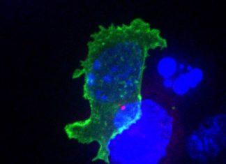Researchers found drugs that are potent cancer-killers when combined
