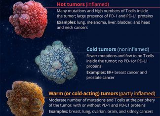 Melanomas can be “hot” or “cold”