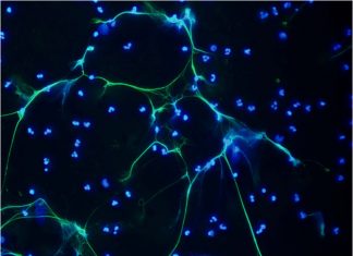 Researchers have identified an alternative treatment for bacterial meningitis