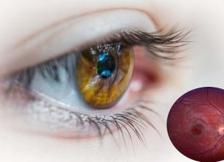 New revolutionary way to treat eye injuries by softening the tissue hosting the stem cells