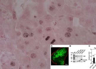 Protein p38γ could become a new pharmacological target in the treatment of liver cancer