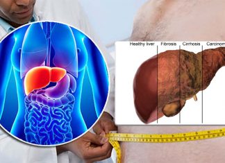Reduce the quantity of active blood platelets it’s a possible option to prevent fatty liver disease and liver cancer
