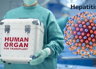 Researchers have blocked the transmission of hepatitis C from infected organ donors to recipients in need of hearts or lungs