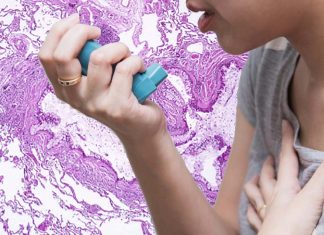 Higher circulating levels of the sex hormone regulator, SHBG, seem to be causally linked to a lower risk of asthma