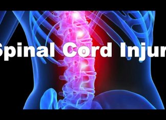 An active lifestyle help the regeneration of damaged nerves after a spinal cord injury