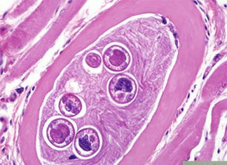 New immune pathway involved in eliminating parasite worms Trichinella spiralis