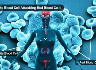Why women get autoimmune diseases far more often than men ?