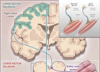 ALS – Researchers discover critical mechanisms of dysfunctional RNA processing