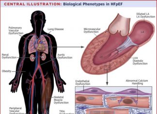 HFpEF is the single greatest unmet need in cardiology