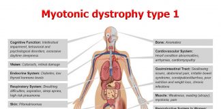 Discovered new therapy to treat myotonic dystrophy type 1