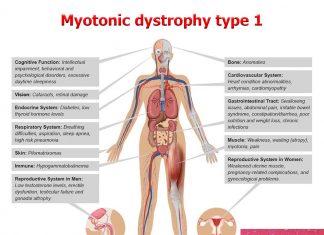 Discovered new therapy to treat myotonic dystrophy type 1
