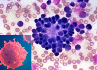 Compound named 5′-iodotubercidin (5′-IT) suppresses the growth of neuroblastoma cells