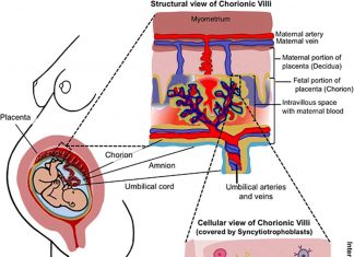 Allopregnanolone (ALLO) can leave fetus vulnerable to autism spectrum disorder (ASD)