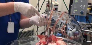 New technique to decontaminate organs before transplantation use ultraviolet and red light irradiation