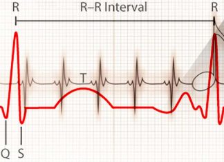 Changes in heart rate help the brain predict the occurrence of an upcoming error