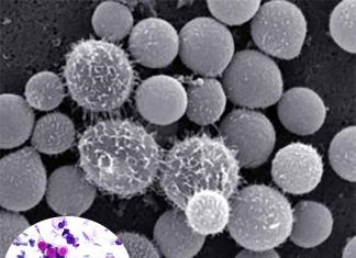 A new study has uncovered how serious fungal infections grow in humans