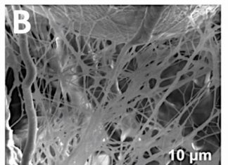 Researchers has developed a gel that allowed new soft tissue to grow – replacing lost tissue
