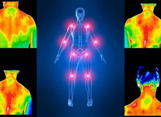 Study finds a pathogenic relationship between insulin resistance and fibromyalgia