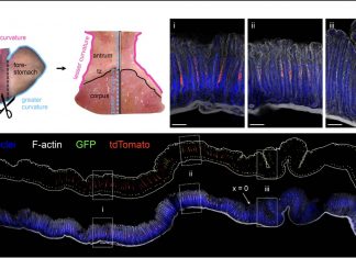 How does Helicobacter pylori find a safe haven in the gastric glands?