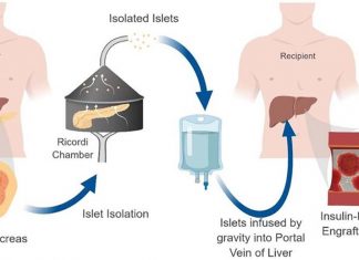 Researchers have developed a standardised method for predicting transplant rejection