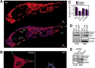 Prostate cancer : Low level of syntaphilin (SNPH) increase risk of metastasis