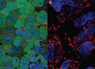 Regenerative medicine : pluripotent stem cells could make a key contribution