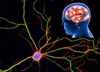 Parkinson’s disease can spread throughout the brain by tiny channels between nerve cells