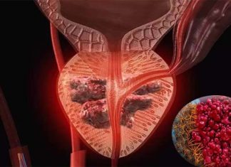 Prostate cancer : drug that targets a protein called PHLPP2 may prevent the cancer cells from spreading to other organs in the body
