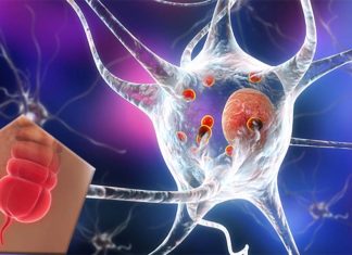 Researchers discover a link between appendectomies and Parkinson’s disease