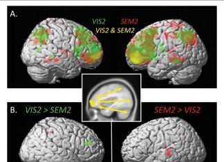 The left rostrolateral prefrontal cortex plays a critical role in memory recall