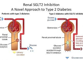 Newer class of medications to treat type 2 diabetes linked to Fournier gangrene