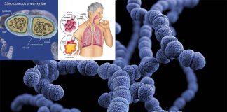 Scientists have reduced transmission of pneumococci using an experimental vaccine