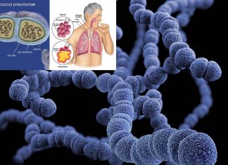 Scientists have reduced transmission of pneumococci using an experimental vaccine