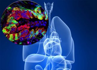 The action of the ATDC gene is required for the development of pancreatic cancer