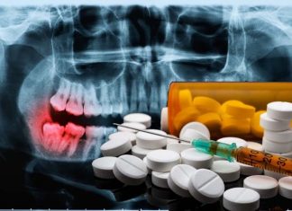 U.S. dentists prescribe 37 times more opioid than in England