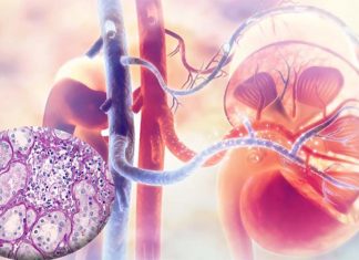 Researchers finds two protein biomarkers to diagnose acute interstitial nephritis (AIN)