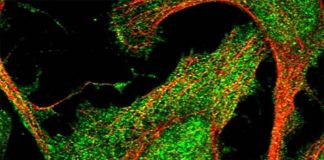 Low levels of adropin predict increased weight gain and metabolic dysregulation