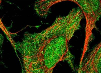 Low levels of adropin predict increased weight gain and metabolic dysregulation