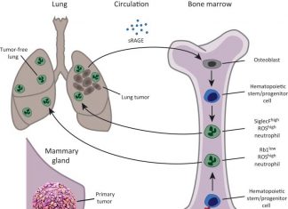 The bone-building osteoblast cells have a complex relationship with cancer