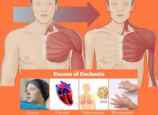 Researchers have described the molecular mechanisms of cachexia during viral infection