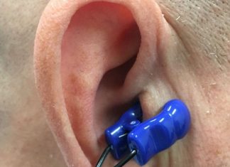 New ear clip can treat atrial fibrillation