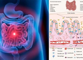 Diagnosis of inflammatory bowel diseases has been linked to a 50% higher mortality rate