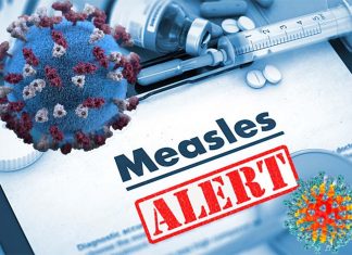 Current vaccination policies are not sufficient to eliminate measles or prevent against future epidemics