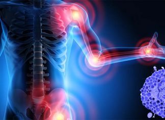 Scientists have definitively linked mast cells to the development of osteoarthritis