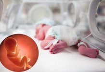 Una terapia innovativa a base di insulina aiuta lo sviluppo digestivo dei bambini prematuri