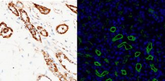 Cells missing a certain protein on their surface can’t move normally